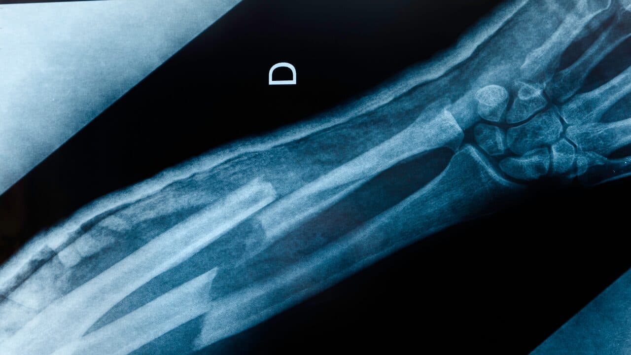 Paediatric forearm radiograph