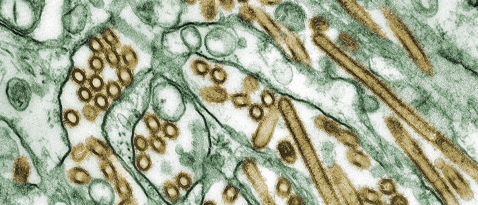 Colour-enhanced electron micrograph of influenza virus particles, shown in gold as round and rod shapes, among green cell membranes.
