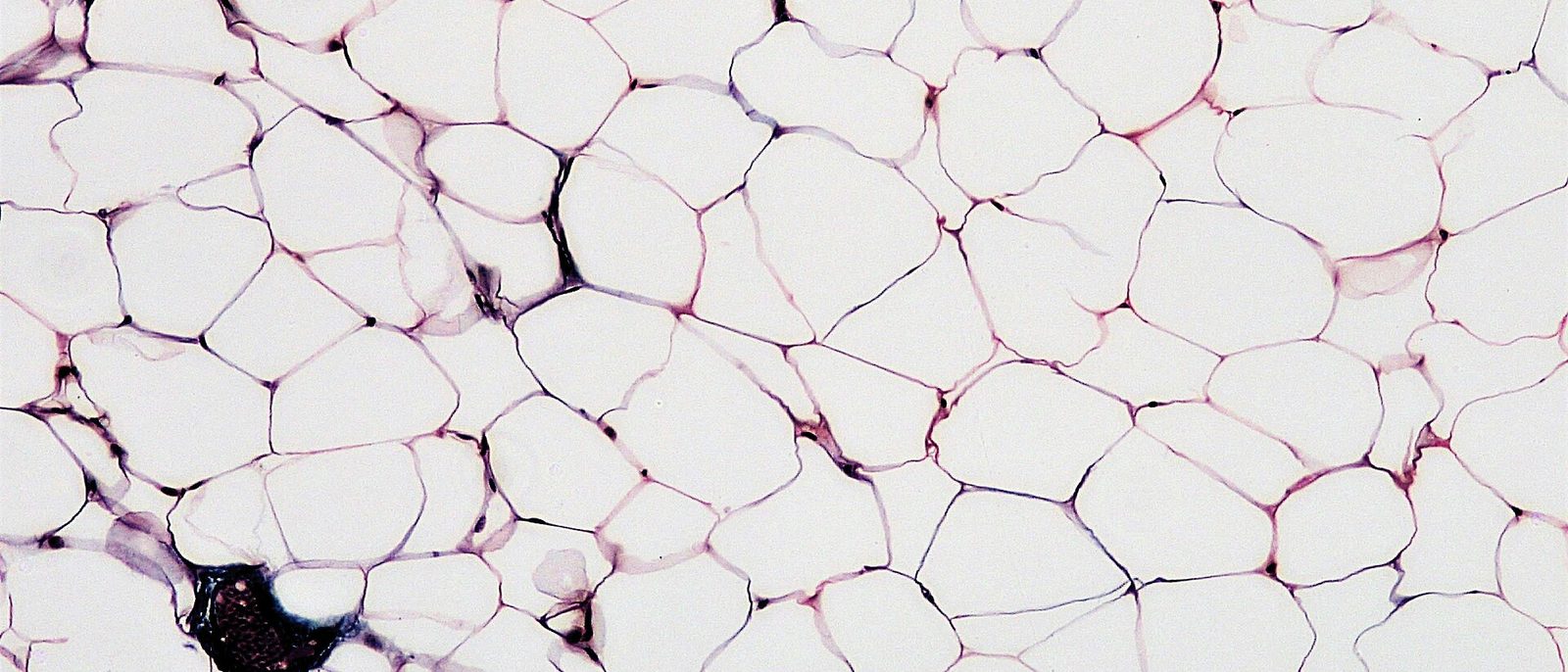 A light micrograph of white adipose tissue showing closely packed fat cells with thin cell membranes.
