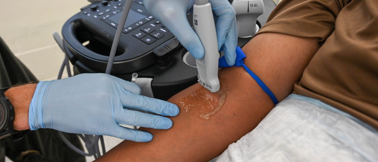 Gloved hands hold an ultrasound probe on a patient's forearm above a tourniquet, with a portable ultrasound machine behind.